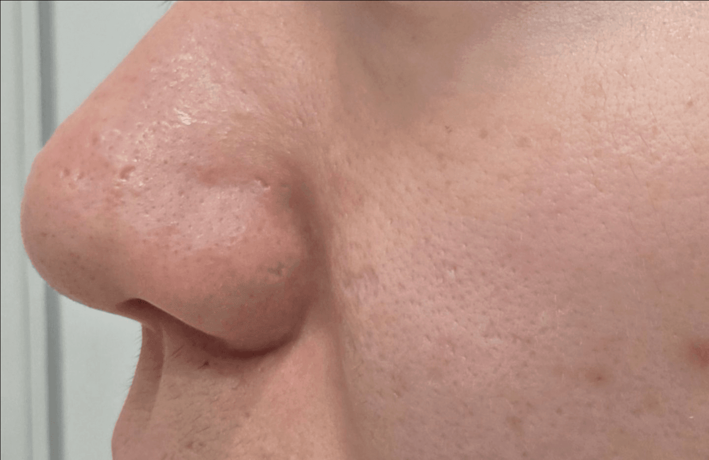 A selected image attached to the source review. Timing and treatment effects have not been independently verified.