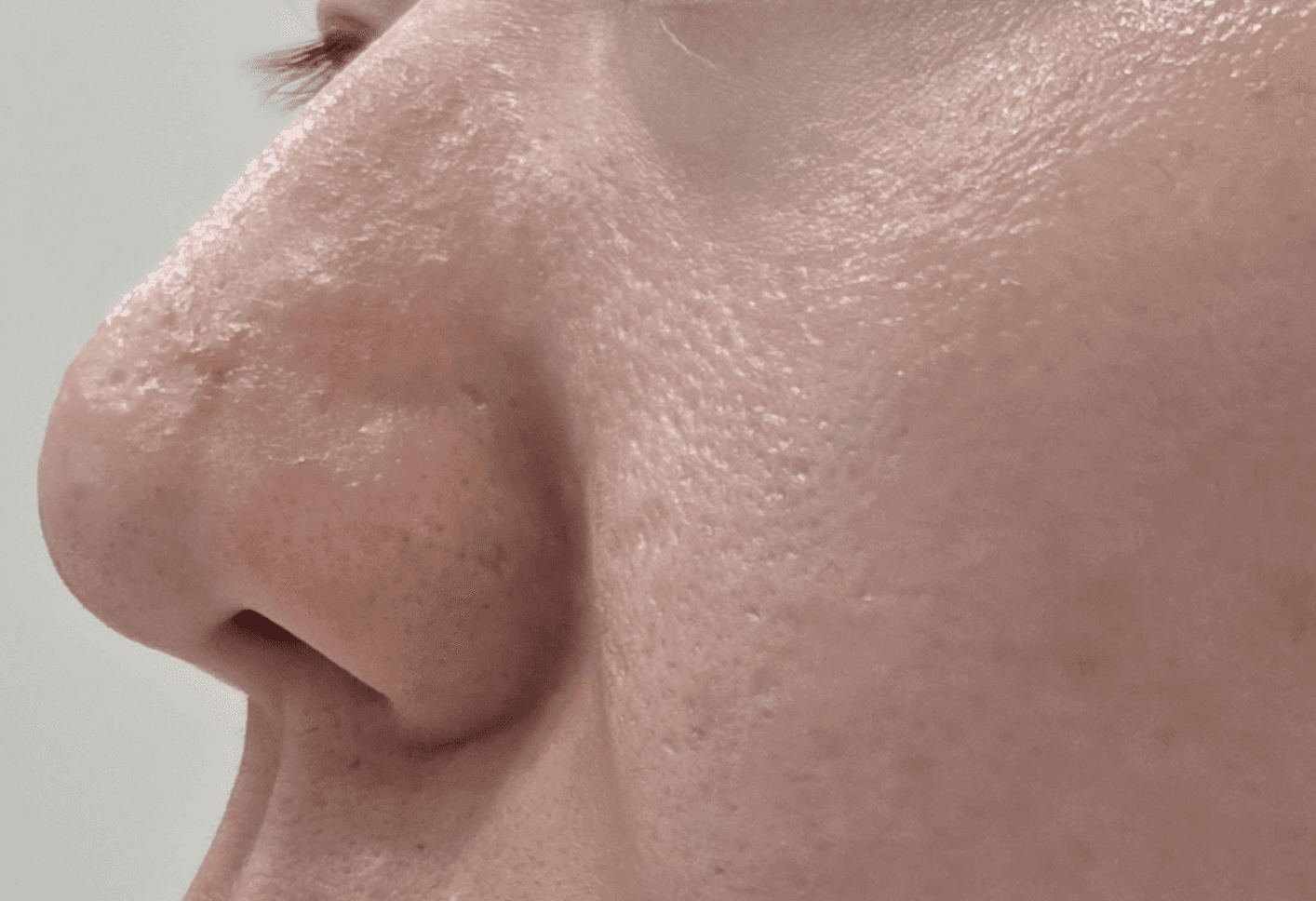 A selected image attached to the source review. Timing and treatment effects have not been independently verified.